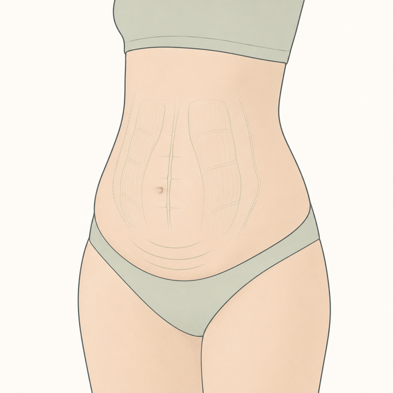 Hängebauch nach der Geburt? Bauch nach Geburt straffen mit dem Twist Crawler